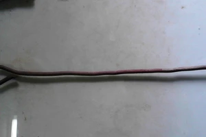 Cậu bé 11 tuổi bị thanh sắt 40cm đâm xuyên hậu môn