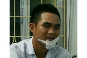 Dùng dao phóng lợn chém cảnh sát giao thông