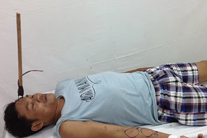 Cứu sống một người bị chỉa ghim vào sọ