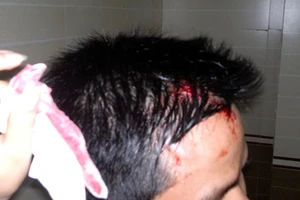 ‘Thượng đế’ bị nhân viên karaoke đánh rách đầu