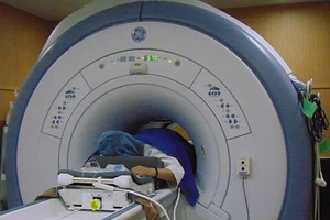 Điều trị u xơ tử cung không cần phẫu thuật