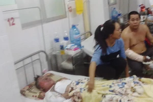 Bỏng nặng do vừa hút thuốc vừa rút xăng