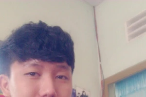 Cắt hàm cứu thanh niên hơn 6 năm không ngậm miệng được