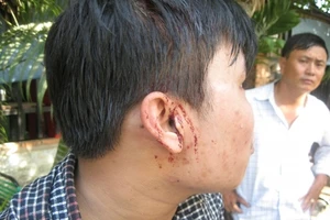 Clip công an dựng lại hiện trường vụ hai phóng viên bị hành hung