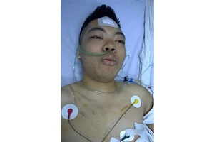 Clip Người bị Việt kiều đâm thấu tim có võ nhưng không đánh lại