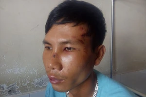 Đồng hương xử nhau vì va chạm giao thông