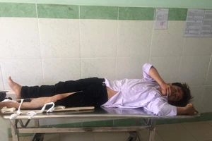 CSGT bị tông gãy chân khi chặn, dừng xe hai thanh niên