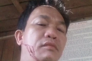 Vận chuyển gỗ lậu, còn đến trạm tấn công cán bộ kiểm lâm 