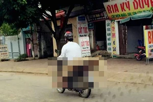 Phê bình bệnh viện trong vụ đưa thi thể bằng xe máy