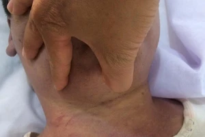 ​Học viên chết bất thường ở trung tâm cai nghiện