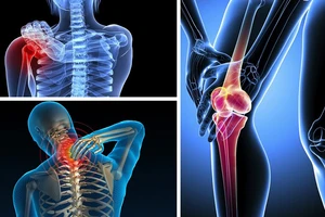 iBONE FiSiO: Nơi gửi trọn niềm tin của bệnh nhân cơ xương khớp