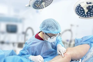 Biến chứng sau điều trị suy giãn tĩnh mạch tại cơ sở ‘chui’