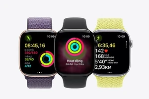 Apple Watch Series 11: Lựa chọn màu sắc, phiên bản dây nào đẹp nhất