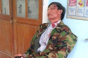 Trưởng công an xã đánh dân phải nhập viện