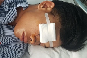 Bị chém trọng thương vì 'hỗn' với đàn anh