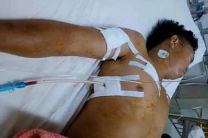 Bị đâm gục vì không chở đi tìm người