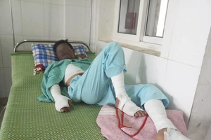 Nổ điện thoại, game thủ bị nước sôi dội vào người