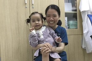 Khối u quái hỗn hợp vùng mặt bé gái 4 tuổi