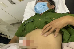 Chiến sĩ công an bị đâm trọng thương khi đang làm nhiệm vụ