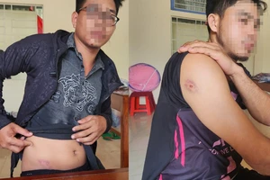 Quảng Trị: 3 người lái máy gặt lúa bị nhóm thanh niên hành hung