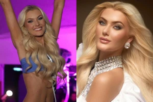 Ngắm nhan sắc như 'búp bê' của tân Hoa hậu Hoàn vũ – Miss Universe 2024