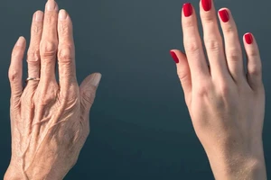 Thay vì uống collagen, hãy thử những thực phẩm này để da đẹp hơn