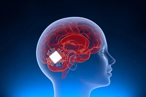 Tin công nghệ ngày 24-8: AI giúp bệnh nhân đột quỵ nói được lần đầu tiên sau 18 năm