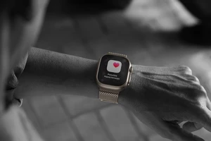 Tin công nghệ 12-9: Apple Watch có thể cảnh báo khi huyết áp tăng cao 