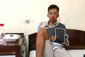 VĐV rời đường đua Cúp TH vì té gãy xương vai