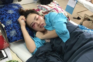 Điều tra vụ 1 phụ nữ bị đánh bầm mắt ở quán bánh xèo
