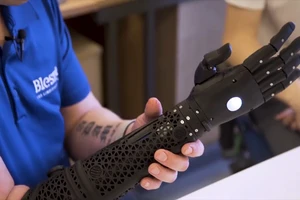 Quân nhân đầu tiên trên thế giới nhận được 'cánh tay anh hùng'