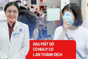 Các biện pháp phòng ngừa bệnh đau mắt đỏ
