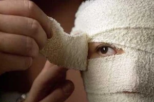 Đua nhau sang Thái du lịch phẩu thuật thẩm mỹ