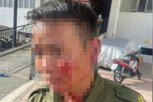 Khống chế thanh niên nghi 'ngáo đá' trong chung cư, 1 thành viên tổ ANTT bị thương