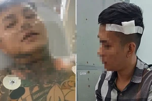 Điều tra nhóm thanh niên đuổi đánh, đâm người trước nhà hàng ở TP.HCM