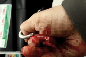 Nhà báo chuyên trách điều tra của báo Lao Động bị hành hung 