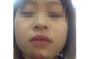 Hành khách “tố” phụ xe buýt hành hung, đuổi khách xuống giữa đường