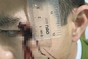 Đánh công an để 'giải cứu’ em trai bị tạm giữ tại trụ sở 