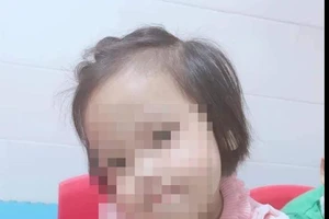 Hà Nội: Bé gái 3 tuổi bị đinh găm vào đầu vẫn hôn mê sau 1 tháng điều trị