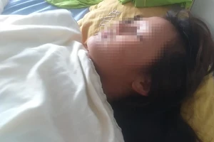 Thêm 2 nữ sinh ở Yên Bái nhập viện trong vụ bạo hành sau lễ tổng kết năm học