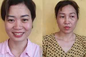 Hải Dương: Khởi tố thêm một bị can làm, sử dụng giấy ra viện giả nhằm trục lợi