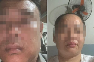 Cặp vợ chồng chuyên ‘chăn dắt’ người ăn xin, bán hàng rong