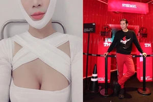 BB Trần làm ngực chuyển giới?