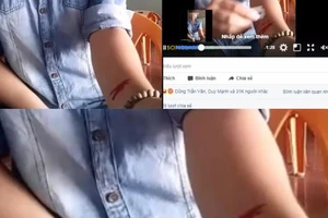 Nghi án nữ sinh 16 tuổi dùng dao lam rạch tay vì tình