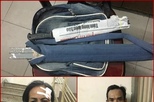 Hình sự quận 1 nổ súng bắt cướp giật ở Công viên 23-9