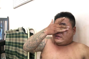 Giọt nước mắt muộn màng của người cha đi cướp giật