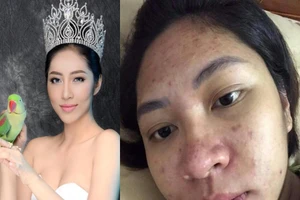 Hoa hậu Đại dương Đặng Thu Thảo kể về khoảng thời gian bị trầm cảm sau sinh