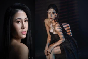 Cô gái mắc bệnh bạch biến thi The Next Face Vietnam 2021 gây xúc động