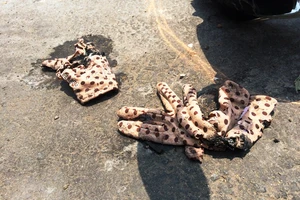 7 phút hoảng loạn khi hai cô gái bị tạt acid tại Sài Gòn