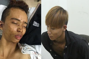 Đề xuất thưởng nóng những người truy bắt cướp bị đâm ở Thủ Đức